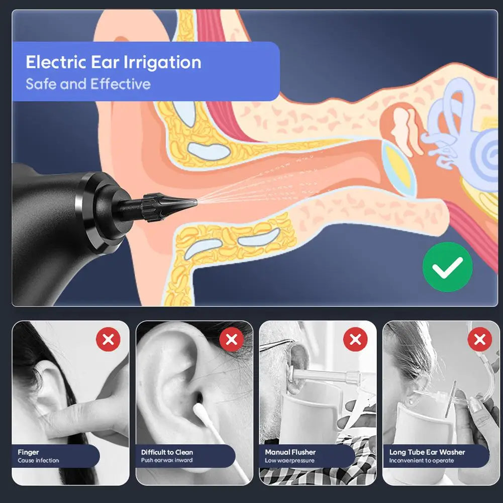 Kit d'élimination du cérumen électrique, nettoyeur d'oreille à eau!